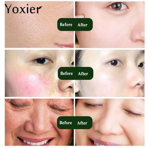 Suero Facial Yoxier Hidratante, Elimina Puntos Negros, Blanqueador, Antiarrugas, Antienvejecimiento, Concentrado de Seis Péptidos de Caracol, Cuidado de la Piel - Product Image 6