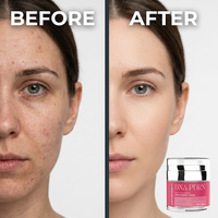 Crème Hydratante Coréenne Anti-Imperfections Corps et Visage à l'Acide Hyaluronique et au PDRN ADN, Soin Éclat et Élasticité de la Peau, Marque Privée