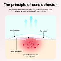 Meilleures ventes OEM Patchs anti-acné hypoallergéniques en forme d'étoile pour le visage, pour le traitement et l'absorption des boutons