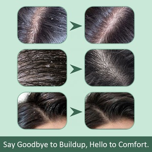 สครับสมุนไพรธรรมชาติเปปเปอร์มินต์สำหรับหนังศีรษะ ออลอินวัน ช่วยฟื้นฟูและทำความสะอาดอย่างล้ำลึก เหมาะสำหรับทุกสภาพเส้นผม - Product Image 4