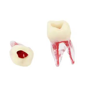 Медицинская Стоматологическая эндодонтическая модель для лечения корневых каналов - Product Image 4