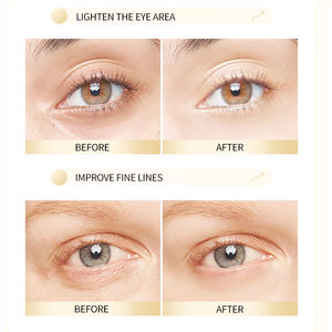 Zlzr Custom Organic Herbal Hydrogel <b>Collagen</b> Under <b>Eye</b> Patches with 24k Gold Gel for Dark Circles - Product Image 5