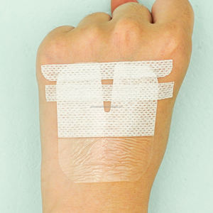 ฟิล์มใส Paediatric ตกแต่งด้วยกรอบขอบสำหรับสายสวน IV หรือหลอดเลือด - Product Image 2