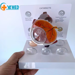 Recursos Didácticos Experimentales de Ciencias Médicas: Globo Ocular Humano, <span class=keywords><strong>Cataratas</strong></span>, Enfermedades Oculares, Pupila - Product Image 1