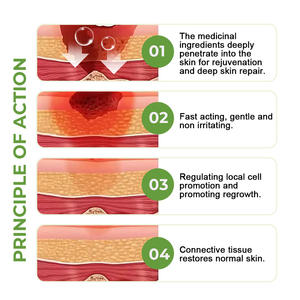Crème en gros pour le traitement des escarres, pommade naturelle et biologique pour les plaies de pression myogènes et les escarres, crème de soin des escarres - Product Image 6
