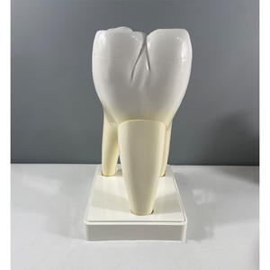 Modelo de Anatomía Humana Ampliado para Enseñanza de Biología y Ciencias Médicas, Modelo de Dientes Molares de 2 Partes con Decadencia Dental - Product Image 5