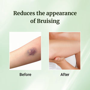 <span class=keywords><strong>Crema</strong></span> <span class=keywords><strong>de</strong></span> árnica <span class=keywords><strong>de</strong></span> alivio natural enriquecida con aceites esenciales <span class=keywords><strong>de</strong></span> hierba <span class=keywords><strong>de</strong></span> limón, eucalipto y Romero, músculos doloridos y rigidez - Product Image 3