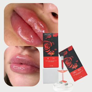 Fournisseur ODM personnalisé de produits pour les lèvres rouges <span class=keywords><strong>1</strong></span> ml, rehausse l'éclat des lèvres, repulpe les lèvres douces, injections BBL - Product Image 3