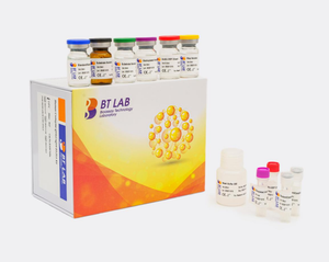 Facteur de <span class=keywords><strong>nécrose</strong></span> <span class=keywords><strong>tumorale</strong></span> humaine E0082Hu Alpha, KIT TNFA ELISA - Product Image 3