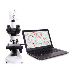 Analizador de <span class=keywords><strong>Semen</strong></span> Veterinario Portátil Automático, Sistema de Análisis de Calidad de Esperma Clínico - Product Image 1