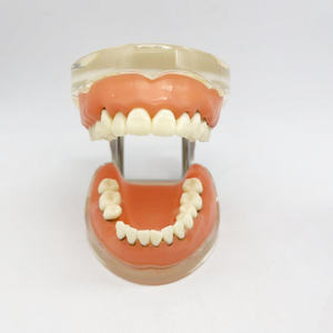 Parodontitis Model Medische Wetenschap Tandheelkundig Model Voor Opleiding In Scholen En Ziekenhuizen - Product Image 6