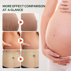 Huile naturelle GREENLEM pour les vergetures et les cicatrices, huile réparatrice pour la peau, à utiliser sur le corps, efficace pour les vergetures et l'élimination des cicatrices, huile pour le ventre plat - Product Image 3