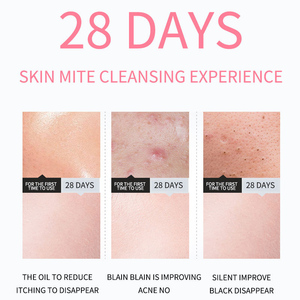 Axit amin mụn sữa rửa mặt lỗ chân lông làm sạch bọt cho tất cả các loại da nhẹ nhàng rửa mặt OEM/ODM - Product Image 6