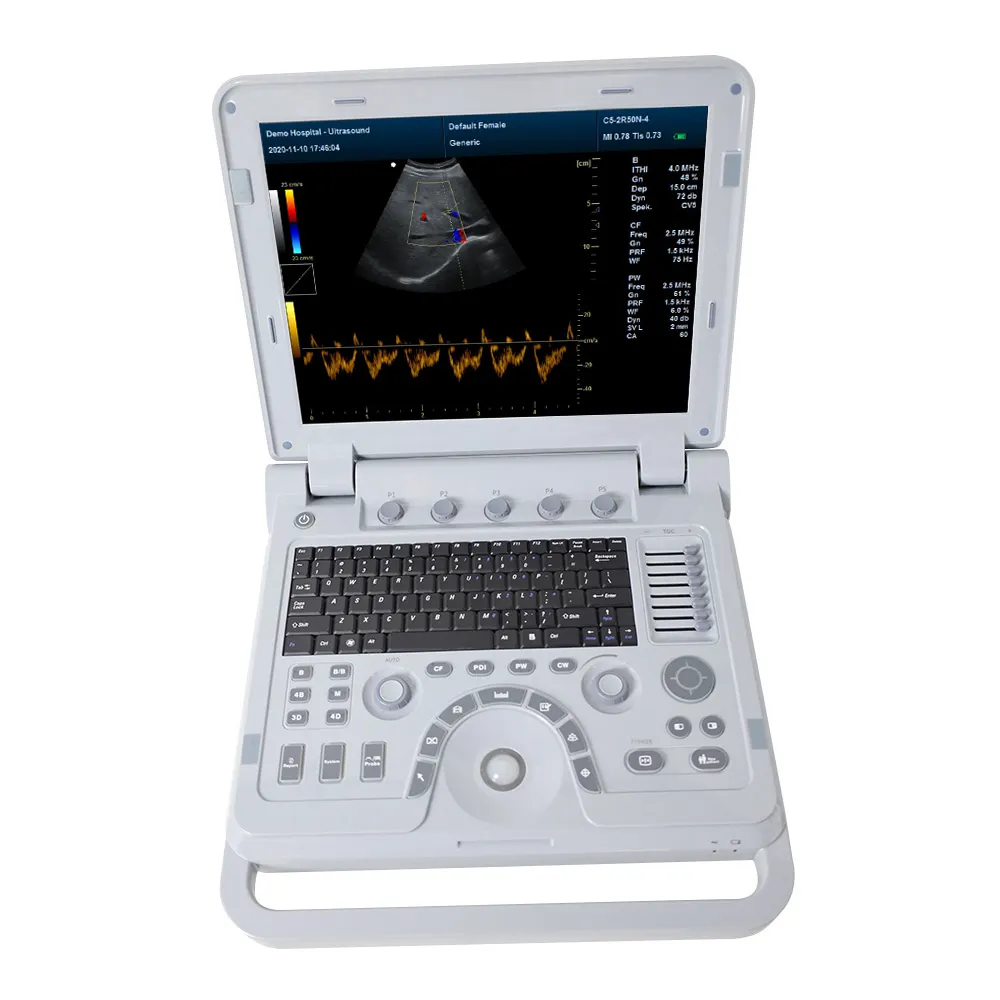 CONTEC CMS1700A-VET tier ärztliche Ultraschall therapie geräte Tierarzt medizinische Farb doppler