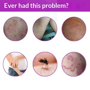 <span class=keywords><strong>เซ</strong></span><span class=keywords><strong>เว่</strong></span><span class=keywords><strong>น</strong></span>เฮิร์บส์ เคลียร์ริ่ง พาร์เพิล ด็อค <span class=keywords><strong>ครีม</strong></span>-<span class=keywords><strong>ครีม</strong></span><span class=keywords><strong>ทา</strong></span>ภายนอกสำหรับรักษาอาการบาดเจ็บที่ผิวห<span class=keywords><strong>น</strong></span>ังที่เกิดจากแมลงกัดต่อย - Product Image 3