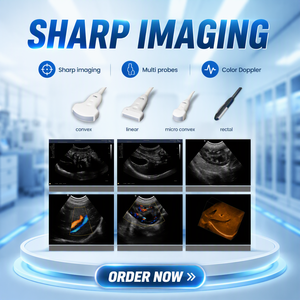 Handheld Pocket Linear Convex Phased Probe <strong>Ultrasound</strong> Scanner 3 in 1 <strong>Ultrasound</strong> Machine Doppler Portable Pocket <strong>Ultrasound</strong> - Product Image 5