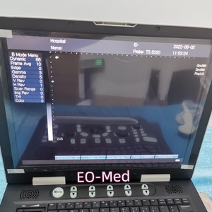 Appareil d'échographie portable pour usage humain BW22, scanner d'échographie portable pour le contrôle corporel - Product Image 3