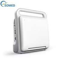 Gerçek Zamanlı Renkli Doppler Ultrason Sonografi Kardiyak Doppler Eko Tıbbi Ultrason Tarayıcı CU60B