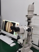 Sistema de Imagenología Digital de Lámpara de Hendidura STARRY de Alta Calidad y Confiabilidad para Diagnóstico en Clínicas Oftalmológicas