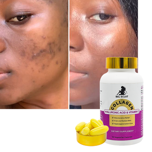 美白サプリメント ビタミンCカプセル 免疫システム＆コラーゲン酸 天然ビーガンコラーゲンカプセル 輝く肌へ - Product Image 1