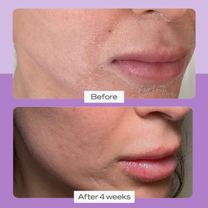 Cosméticos Belleza Reparación <span class=keywords><strong>Exfoliante</strong></span> Cara Cuerpo KP <span class=keywords><strong>Exfoliante</strong></span> Brillo Purificante Removedor de <span class=keywords><strong>piel</strong></span> muerta suave <span class=keywords><strong>Exfoliante</strong></span> <span class=keywords><strong>facial</strong></span> - Product Image 6