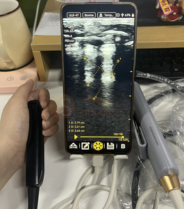 Hitam dan putih kabel <span class=keywords><strong>USB</strong></span> transmainan Ultrasound 80 elemen mesin Ultrasound untuk sapi/kuda - Product Image 4