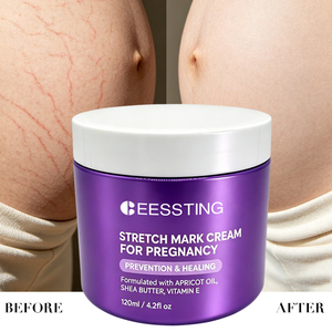 Produits de soin corporel naturels et biologiques à marque privée, crème anti-vergetures pour la grossesse - Product Image 2