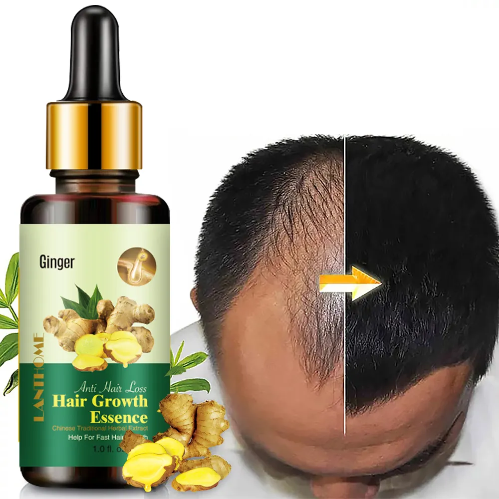 Óleo de gengibre para crescimento de cabelo, óleo essencial para crescimento do cabelo com 30ml, 7 dias, sérum de tratamento para perda de cabelo