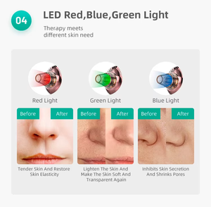 Nouveau <span class=keywords><strong>aspirateur</strong></span> électrique pour pores de beauté dissolvant de points noirs nettoyant pour pores du visage dissolvant de tête noire pour le visage - Product Image 4