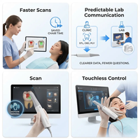 Shining 3D Aoralscan L: Solución de Escaneo Digital Dental Optimizada con Tecnología Cloud, Aleación de Aluminio Aeronáutico, 1 Año de Garantía