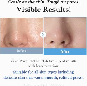 Medicube Toner Pads Zero Pore Pad 2.0 : Disques exfoliants et soin des pores à l'acide lactique AHA – Soin coréen pour la peau - Product Image 2