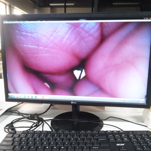 0.65 x0.65 mm 1mm 200P ovm6948 1mm máy ảnh mô-đun Kit USB nội soi - Product Image 3