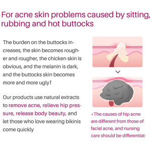 Crème anti-acné pour les fesses et les cuisses Sauvasine 50ml, lissante, hydratante, raffermissante et éclaircissante - Product Image 6