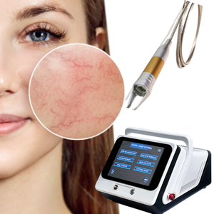I vasi sanguigni rossi indolori 980nm rimuovono la macchina <span class=keywords><strong>Laser</strong></span> medica a diodi per rimozione vascolare ad alta frequenza della vena del ragno - Product Image 1
