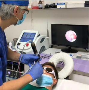 Laser dentale per cavità 980nm diodo laser tessuto molle taglio dentario endolaser fungo per unghie lipolisi vena ragno - Product Image 5