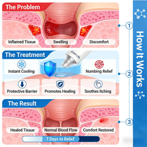 Tecnología de Enfriamiento y Analgesia Perianal con Mentol al 0.1%, Alivia la Sensación de Ardor/Picazón/Dolor <span class=keywords><strong>en</strong></span> Cuestión de Segundos - Product Image 4