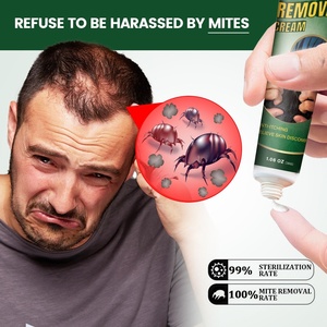 Crème anti-acariens naturelle à base de plantes de haute qualité-Apaise les démangeaisons du cuir chevelu, élimine les acariens du cuir chevelu, doux pour un usage quotidien - Product Image 6