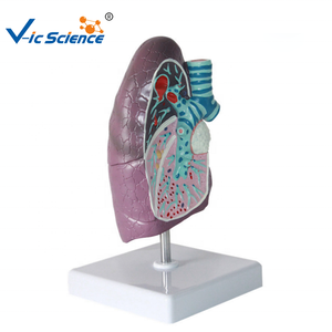 Modelo patológico de pulmón humano con enfermedades, modelo de pulmón visceral de fumador, modelo de enseñanza del sistema respiratorio - Product Image 1