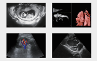 Appareil de diagnostic à ultrasons couleur sur chariot – Scanner d'échographie exclusif portable 3D/4D/5D – Équipement médical d'échographie