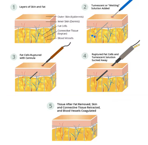 Penjualan Terbaik <span class=keywords><strong>Laser</strong></span> terapi fisik kelas <span class=keywords><strong>IV</strong></span> 980nm 1470nm photobiomodulation untuk penyembuhan luka dan nyeri pergelangan tangan - Product Image 5