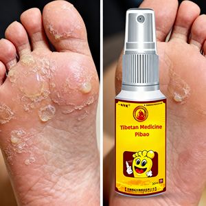 Spray Herbal Sin Hormonas para el Alivio de <span class=keywords><strong>la</strong></span> Picazón por <span class=keywords><strong>Hongos</strong></span> <span class=keywords><strong>en</strong></span> los Pies para Adultos, Reparación de <span class=keywords><strong>la</strong></span> Descamación y Cuidado de <span class=keywords><strong>la</strong></span> <span class=keywords><strong>Piel</strong></span> Seca - Product Image 4