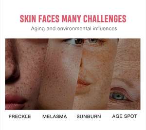 Crème Visage Anti-Taches QBEKA Beauty Skincare Ingrédients Naturels Éliminateur de Taches de Rousseur, Taches Solaires, Taches de Vieillesse, <span class=keywords><strong>Correcteur</strong></span> de Taches Brunes - Product Image 6