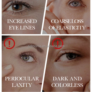 2025 Vente chaude Hydrogel sous les yeux Patches Beauté Hydratant Papillon Masque pour les yeux - Product Image 4