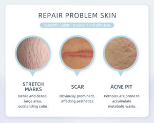 เครื่องเลเซอร์เศษส่วน Co2สำหรับกำจัดริ้วรอยบนผิวกระ Co2เลเซอร์เศษส่วน - Product Image 5