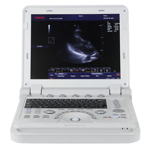 CONTEC CMS1700B sonde linéaire bébé machine à ultrasons chine machine à ultrasons pour la grossesse - Product Image 4