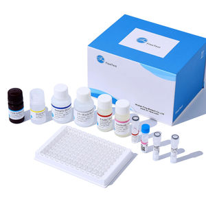 FineTest özel kimyasal hizmetler sığır HSP70 ELISA seti bilimsel araştırma ısı şok protein 70 - Product Image 1