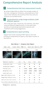 Analyseur capillaire portable Al Algorithm – Appareil de diagnostic du cuir chevelu avec stockage cloud et recommandations d'analyse folliculaire pour usage commercial - Product Image 6