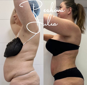 Máquina de Rejuvenecimiento Facial con Láser de Diodo de <span class=keywords><strong>980</strong></span>+1470nm, Endoláser para Estiramiento de la Piel, Lipólisis con Fibra Óptica, Contorno Corporal con Láser - Product Image 5