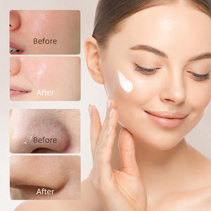 Soins de la peau en marque privée Non irritant Non gras Hydratation intense Lissage de la peau Anti-âge Crème <span class=keywords><strong>au</strong></span> <span class=keywords><strong>lait</strong></span> <span class=keywords><strong>d</strong></span>'ânesse - Product Image 3