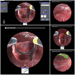 Simulateur d'hystéroscopie avec retour de force haptique |   Système de formation chirurgicale en réalité virtuelle <span class=keywords><strong>pour</strong></span> la gynécologie - Product Image 5